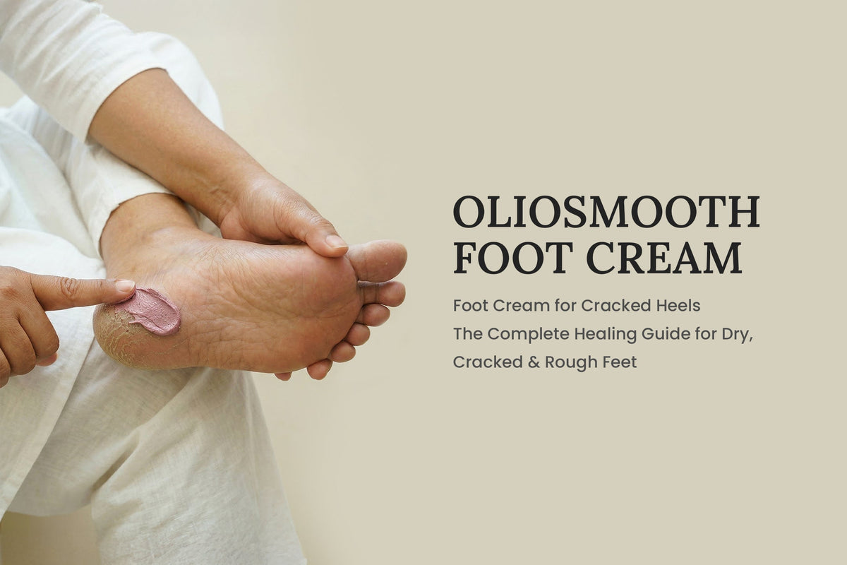 Foot Cream for Cracked Heels - The Complete Healing Guide for Dry, Cracked & Rough Feet
